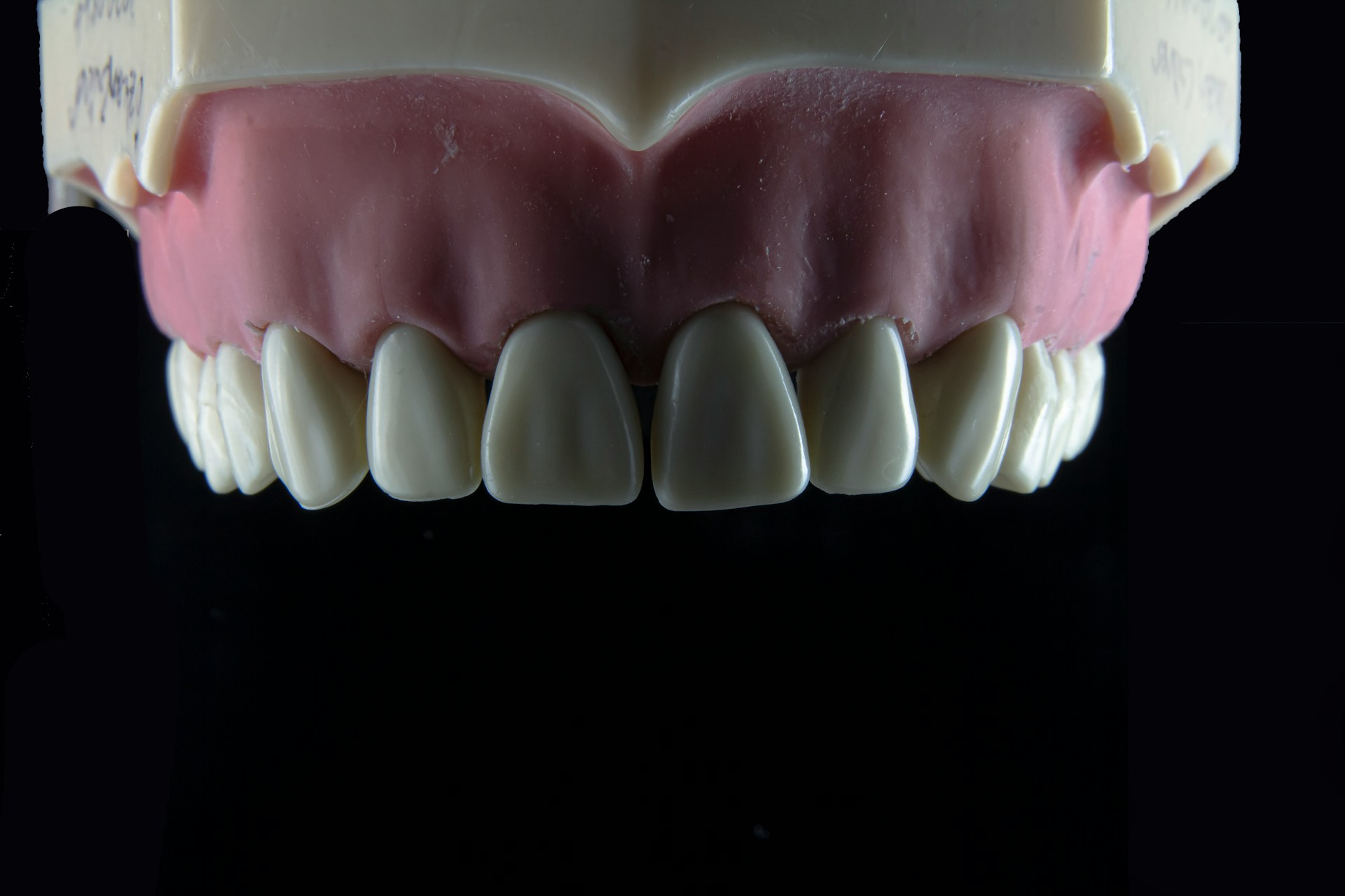 Dental bone grafting and implant site preparation